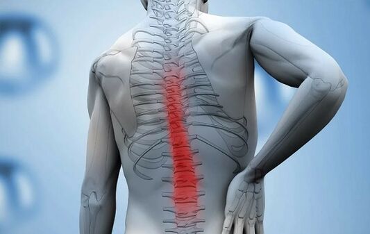 Réckschmerzen an der Lendegéigend wéinst Ankyloserende Spondylitis