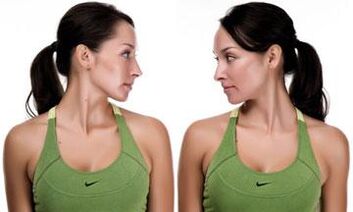 Übungen fir zervikal Osteochondrose fir effektiv Behandlung vun der Krankheet